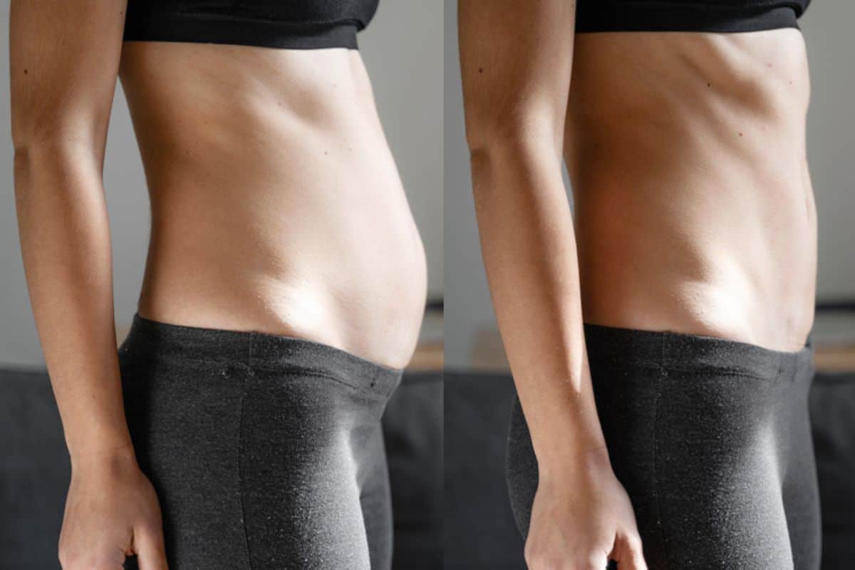 Post-Pregnancy: What Happens to Your Abdominal Muscles After Birth Greater London (Westminster)