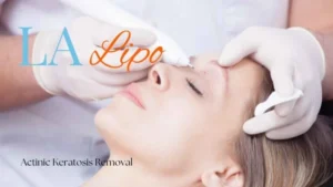 Woman receiving Actinic Keratosis Removal Treatment Greater London (Westminster)