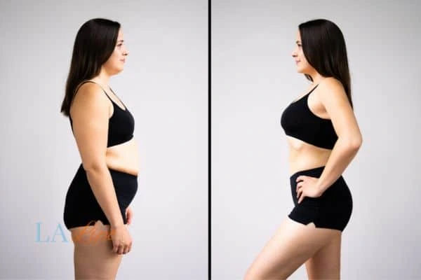 LA-EMS Body Sculpting Greater London (Westminster) results before and after of womans results on body toning.