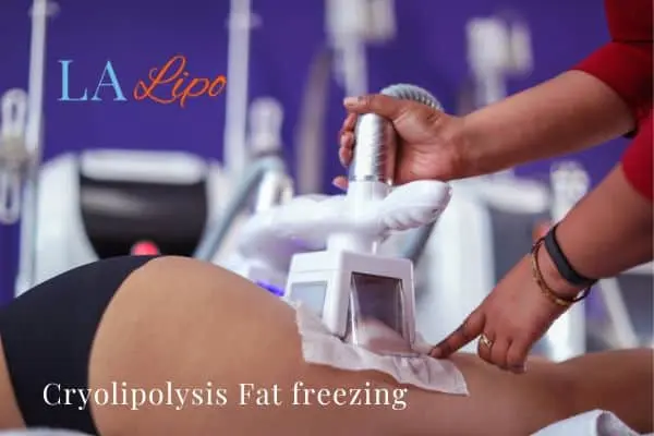 women getting fat freezing Greater London (Westminster)