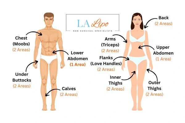 LA LIPO Cryolipolysis Areas Greater London (Westminster)