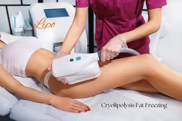 Woman receiving coolsculpting Greater London (Westminster) treatment on her thighs