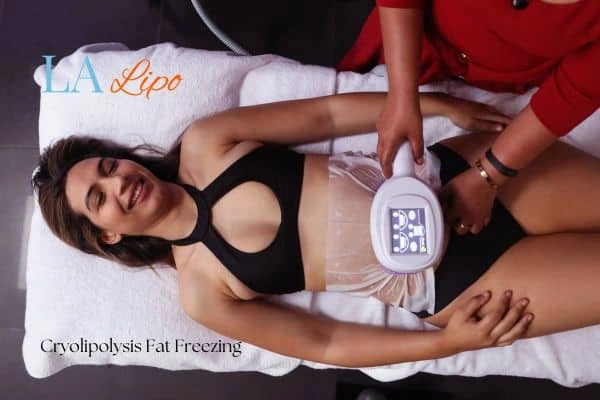woman getting cryolipolysis Greater London (Westminster)