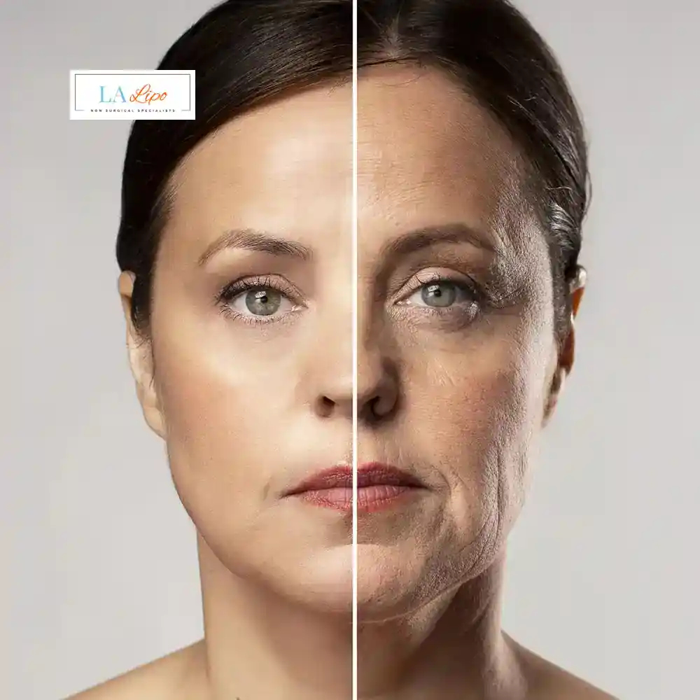 How Can You Tell If Non-Surgical Skin Tightening Is Right for You Greater London (Westminster)?